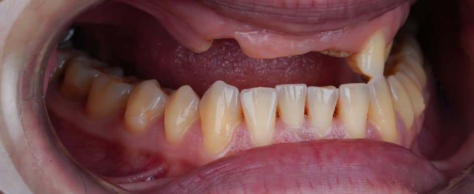 Premium Makeover - Before